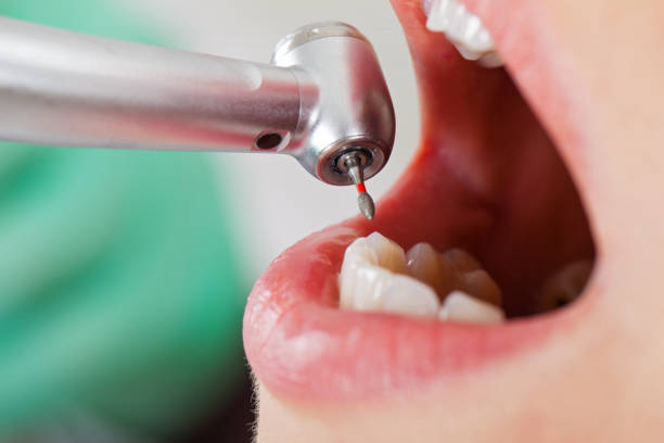 Best Walk-In Emergency Dental Services in Gridley, CA